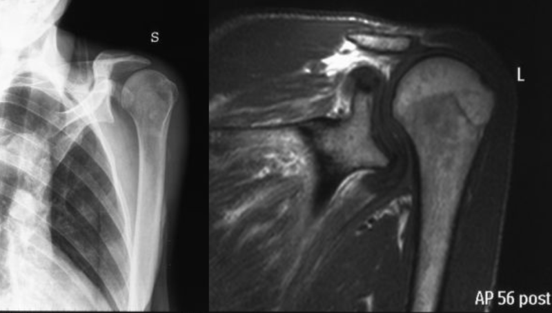 File:Incarceration sup.png