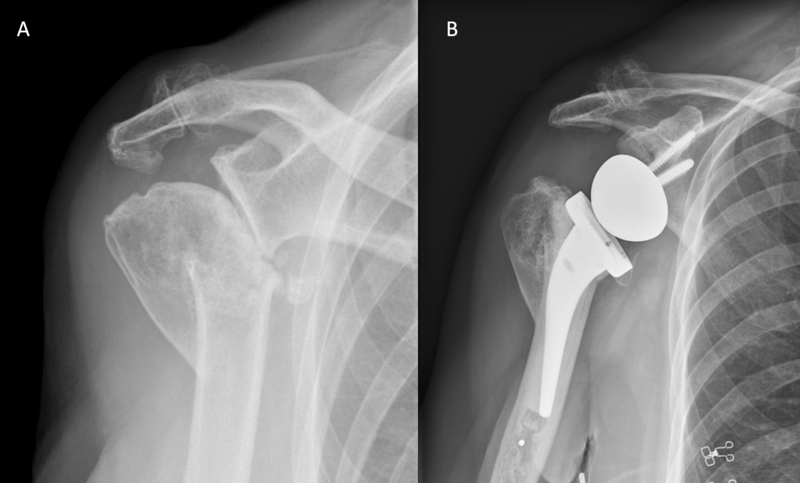 File:Malunion Rickenbach.png