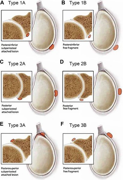 File:Figure 21 jpeg.jpg