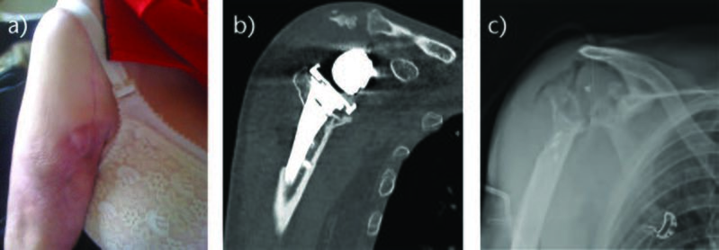 File:Eor-2-104 2.jpg