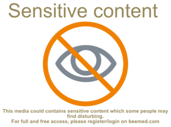 Sensitive-content.png