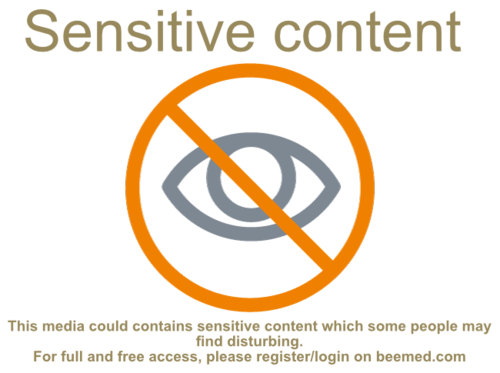 Sensitive-content.png