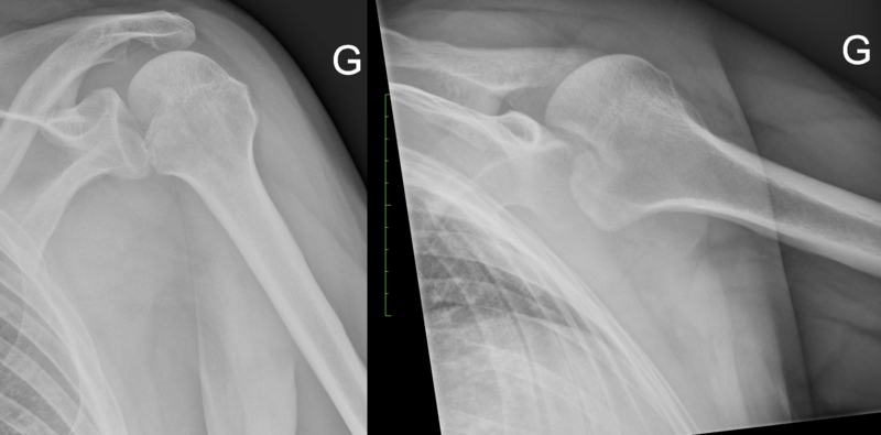 File:Locked dislocation.png