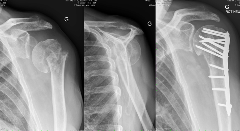 File:Cure malunion.png