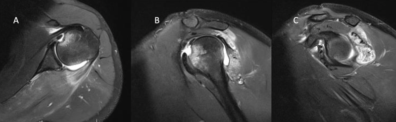 File:Post dislocation.png